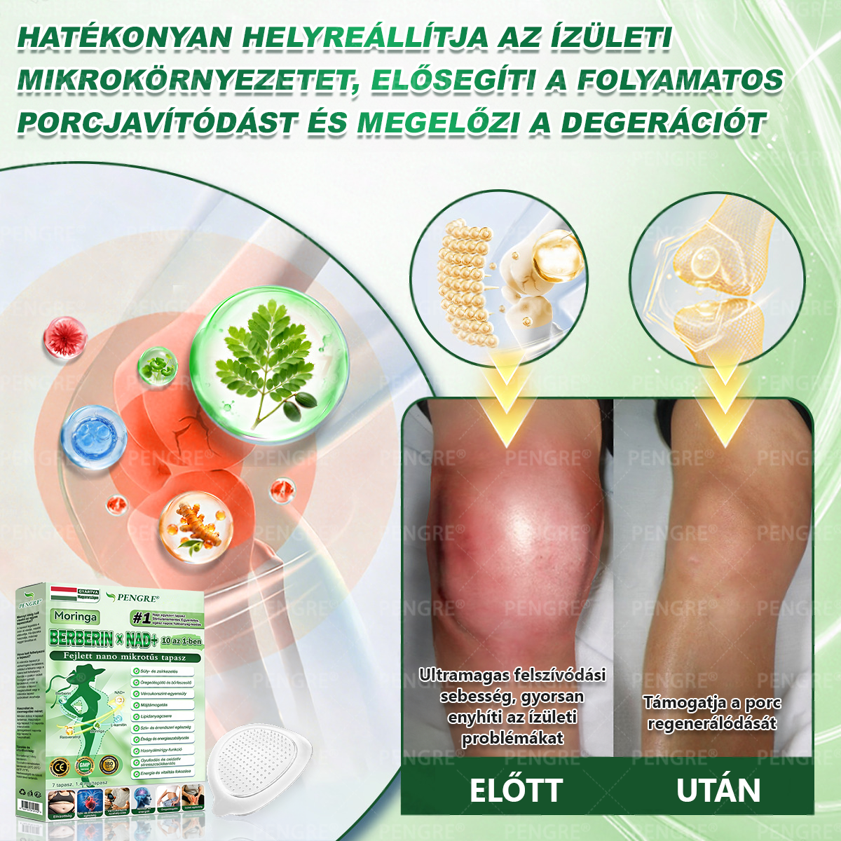 🌷𝐏𝐄𝐍𝑮𝑹𝐄® 𝗠𝗼𝗿𝗶𝗻𝗴𝗮 × 𝗕𝗲𝗿𝗯𝗲𝗿𝗶𝗻𝗲 × 𝗔𝗠𝗣𝗞 𝟭𝟬-𝗶𝗻-𝟭 𝗠𝗲𝘁𝗮𝗯𝗼𝗹𝗶𝗰 𝗦𝘂𝗽𝗽𝗼𝗿𝘁 𝗡𝗮𝗻𝗼 𝗠𝗶𝗰𝗿𝗼𝗻𝗲𝗲𝗱𝗹𝗲 𝗣𝗮𝘁𝗰𝗵 🇭🇺 (𝐍𝐚𝐩𝐨𝐧𝐭𝐚 𝐜𝐬𝐚𝐤 𝐞𝐠𝐲𝐬𝐳𝐞𝐫, 𝐥𝐚́𝐭𝐡𝐚𝐭𝐨́ 𝐯𝐚́𝐥𝐭𝐨𝐳𝐚́𝐬𝐨𝐤 𝐦𝐚́𝐫 𝟕 𝐧𝐚𝐩 𝐚𝐥𝐚𝐭𝐭) ✅ 𝐄𝐥𝐡𝐢́𝐳𝐚́𝐬𝐫𝐚, 𝐜𝐮𝐤𝐨𝐫𝐛𝐞𝐭𝐞𝐠𝐬𝐞́𝐠𝐫𝐞, 𝐚𝐥𝐯𝐚́𝐬𝐢 𝐚𝐩𝐧𝐨𝐞́𝐫𝐚, 𝐢́𝐳𝐮̈𝐥𝐞𝐭𝐢 𝐩𝐫𝐨𝐛𝐥𝐞́𝐦𝐚́𝐤𝐫𝐚 𝐞́𝐬 𝐦𝐞́𝐠 𝐬𝐨𝐤 𝐦𝐚́𝐬𝐫𝐚 🔥
