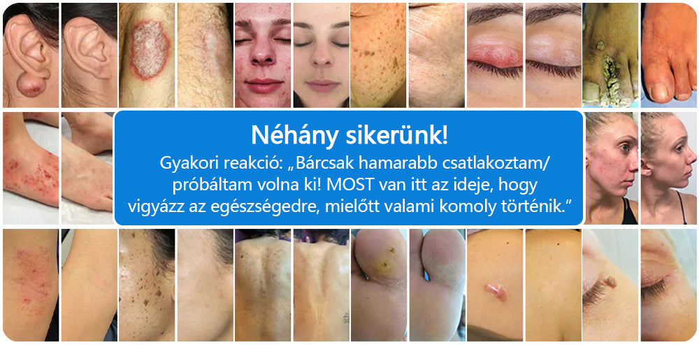 CleraNature® Magnéziumos Spray – Gyors Enyhülés Viszkető, Vörös és Érzékeny Bőrre (Még Intim Területeken is)✨