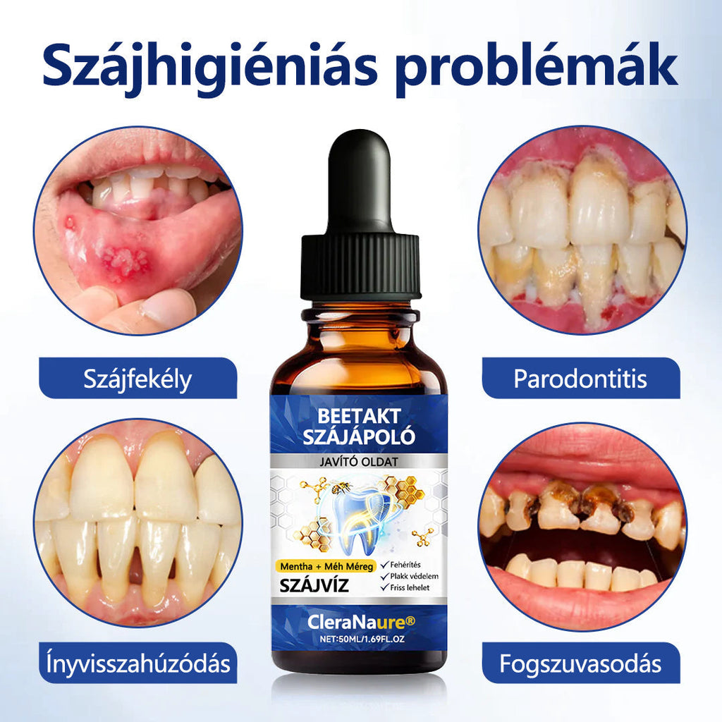 💎CleraNaure® BeeTakt Szájápoló Javító Oldat ✨💙