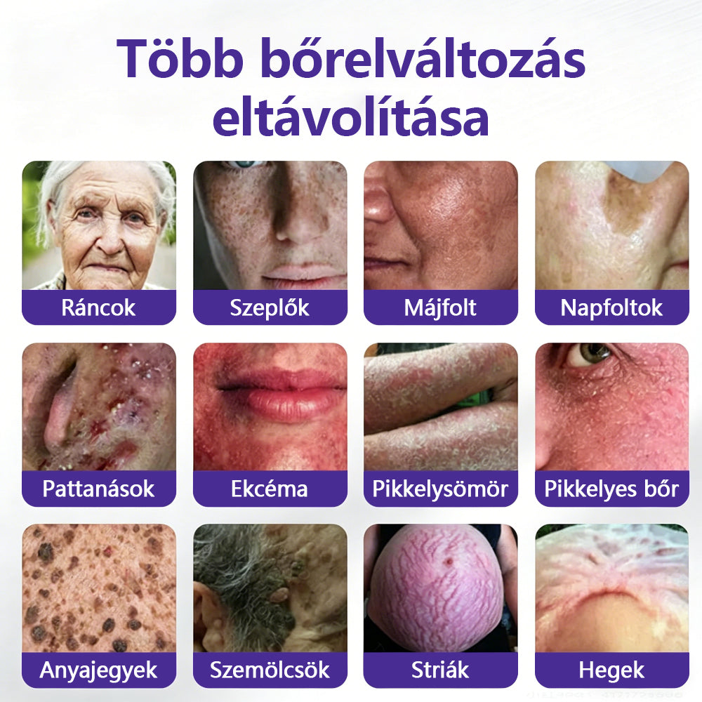 👩🏻‍⚕️COLTURE® szemölcs- és anyajegytávolító mikrotűs tapasz