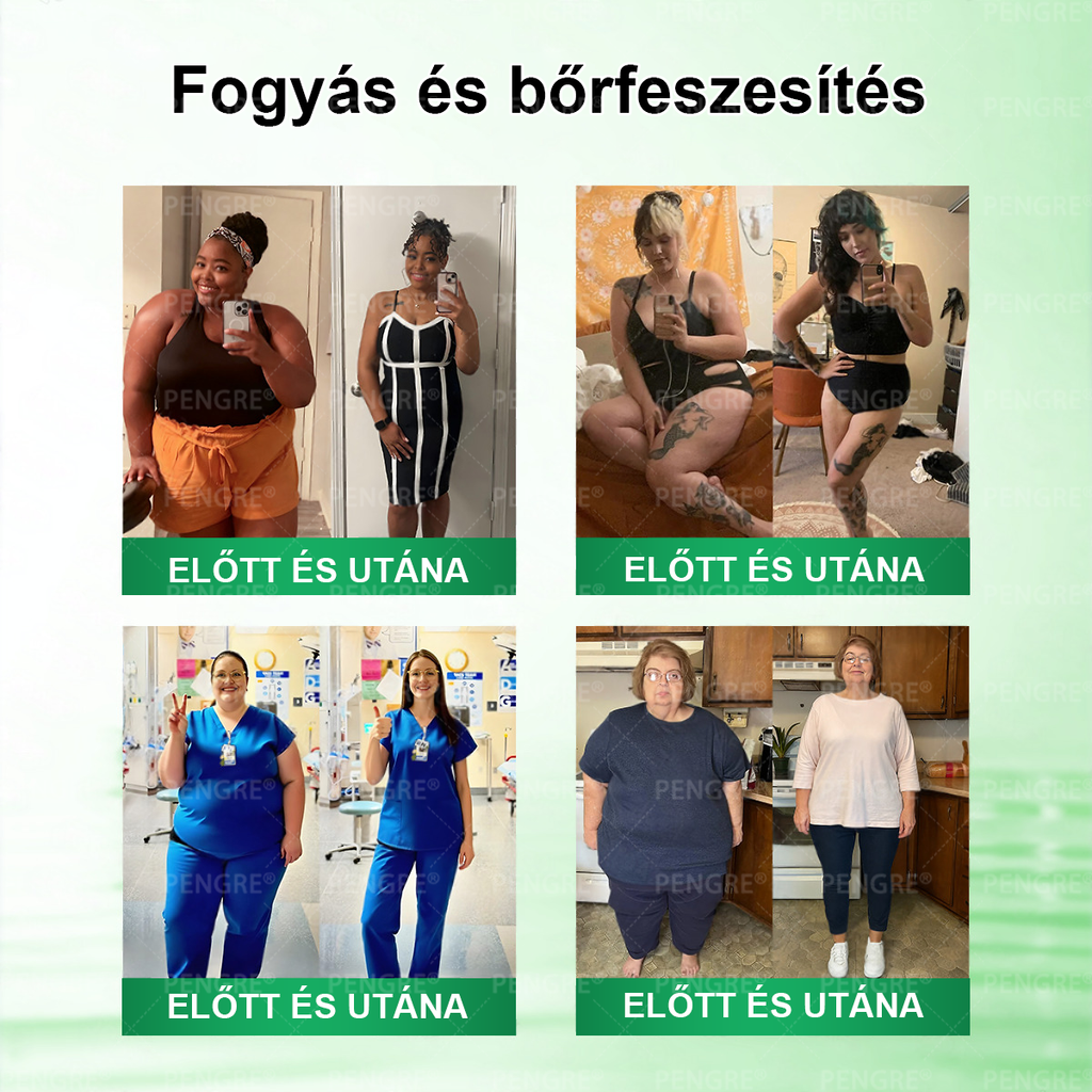 🌷𝐏𝐄𝐍𝑮𝑹𝐄® 𝗠𝗼𝗿𝗶𝗻𝗴𝗮 × 𝗕𝗲𝗿𝗯𝗲𝗿𝗶𝗻𝗲 × 𝗔𝗠𝗣𝗞 𝟭𝟬-𝗶𝗻-𝟭 𝗠𝗲𝘁𝗮𝗯𝗼𝗹𝗶𝗰 𝗦𝘂𝗽𝗽𝗼𝗿𝘁 𝗡𝗮𝗻𝗼 𝗠𝗶𝗰𝗿𝗼𝗻𝗲𝗲𝗱𝗹𝗲 𝗣𝗮𝘁𝗰𝗵 🇭🇺 (𝐍𝐚𝐩𝐨𝐧𝐭𝐚 𝐜𝐬𝐚𝐤 𝐞𝐠𝐲𝐬𝐳𝐞𝐫, 𝐥𝐚́𝐭𝐡𝐚𝐭𝐨́ 𝐯𝐚́𝐥𝐭𝐨𝐳𝐚́𝐬𝐨𝐤 𝐦𝐚́𝐫 𝟕 𝐧𝐚𝐩 𝐚𝐥𝐚𝐭𝐭) ✅ 𝐄𝐥𝐡𝐢́𝐳𝐚́𝐬𝐫𝐚, 𝐜𝐮𝐤𝐨𝐫𝐛𝐞𝐭𝐞𝐠𝐬𝐞́𝐠𝐫𝐞, 𝐚𝐥𝐯𝐚́𝐬𝐢 𝐚𝐩𝐧𝐨𝐞́𝐫𝐚, 𝐢́𝐳𝐮̈𝐥𝐞𝐭𝐢 𝐩𝐫𝐨𝐛𝐥𝐞́𝐦𝐚́𝐤𝐫𝐚 𝐞́𝐬 𝐦𝐞́𝐠 𝐬𝐨𝐤 𝐦𝐚́𝐬𝐫𝐚 🔥