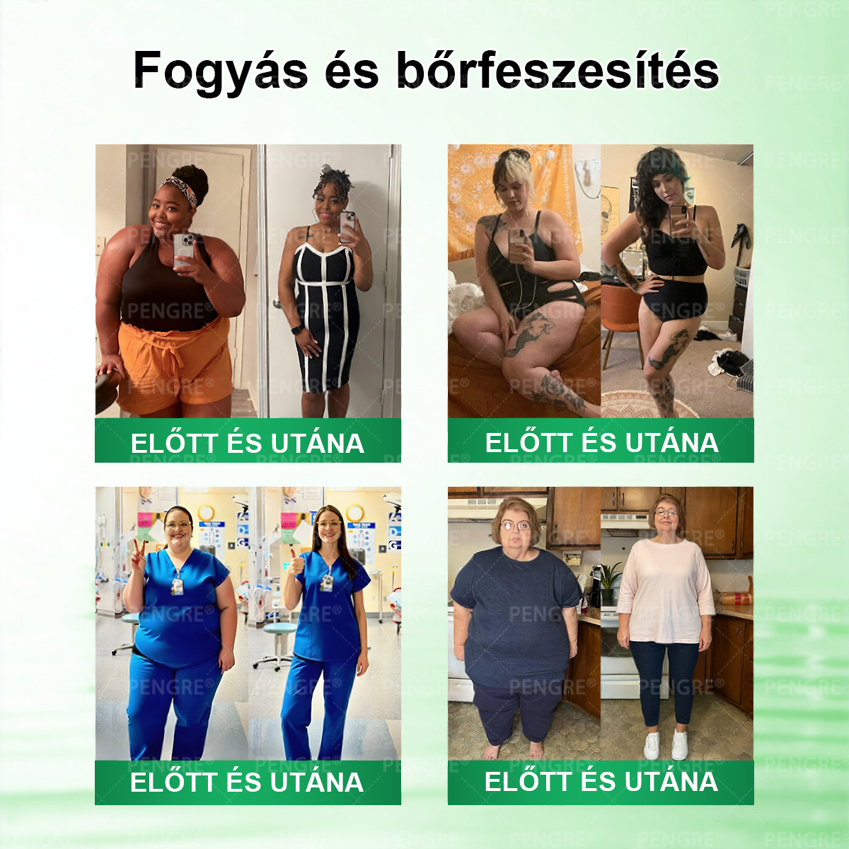 🌷𝐏𝐄𝐍𝑮𝑹𝐄® 𝗠𝗼𝗿𝗶𝗻𝗴𝗮 × 𝗕𝗲𝗿𝗯𝗲𝗿𝗶𝗻𝗲 × 𝗔𝗠𝗣𝗞 𝟭𝟬-𝗶𝗻-𝟭 𝗠𝗲𝘁𝗮𝗯𝗼𝗹𝗶𝗰 𝗦𝘂𝗽𝗽𝗼𝗿𝘁 𝗡𝗮𝗻𝗼 𝗠𝗶𝗰𝗿𝗼𝗻𝗲𝗲𝗱𝗹𝗲 𝗣𝗮𝘁𝗰𝗵 🇭🇺 (𝐍𝐚𝐩𝐨𝐧𝐭𝐚 𝐜𝐬𝐚𝐤 𝐞𝐠𝐲𝐬𝐳𝐞𝐫, 𝐥𝐚́𝐭𝐡𝐚𝐭𝐨́ 𝐯𝐚́𝐥𝐭𝐨𝐳𝐚́𝐬𝐨𝐤 𝐦𝐚́𝐫 𝟕 𝐧𝐚𝐩 𝐚𝐥𝐚𝐭𝐭) ✅ 𝐄𝐥𝐡𝐢́𝐳𝐚́𝐬𝐫𝐚, 𝐜𝐮𝐤𝐨𝐫𝐛𝐞𝐭𝐞𝐠𝐬𝐞́𝐠𝐫𝐞, 𝐚𝐥𝐯𝐚́𝐬𝐢 𝐚𝐩𝐧𝐨𝐞́𝐫𝐚, 𝐢́𝐳𝐮̈𝐥𝐞𝐭𝐢 𝐩𝐫𝐨𝐛𝐥𝐞́𝐦𝐚́𝐤𝐫𝐚 𝐞́𝐬 𝐦𝐞́𝐠 𝐬𝐨𝐤 𝐦𝐚́𝐬𝐫𝐚 🔥