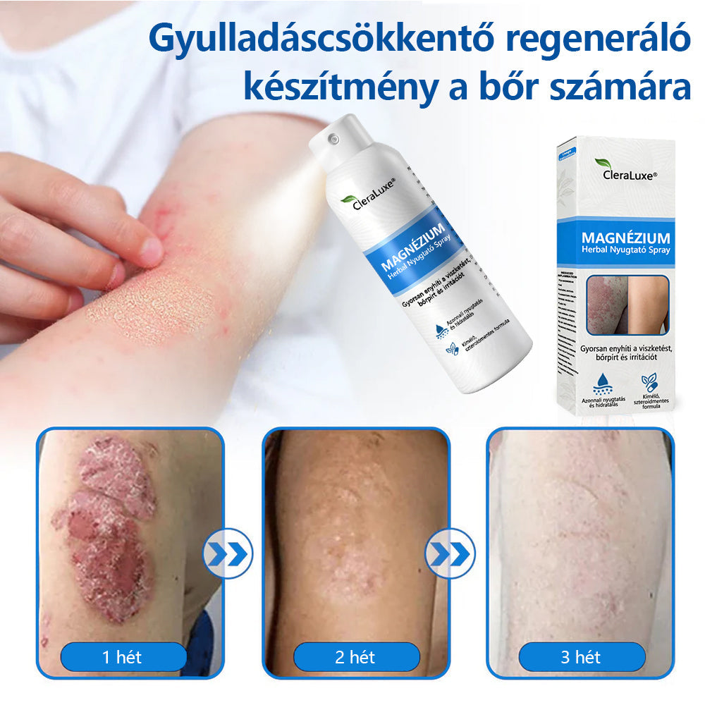 CleraNature® Magnéziumos Spray – Gyors Enyhülés Viszkető, Vörös és Érzékeny Bőrre (Még Intim Területeken is)✨