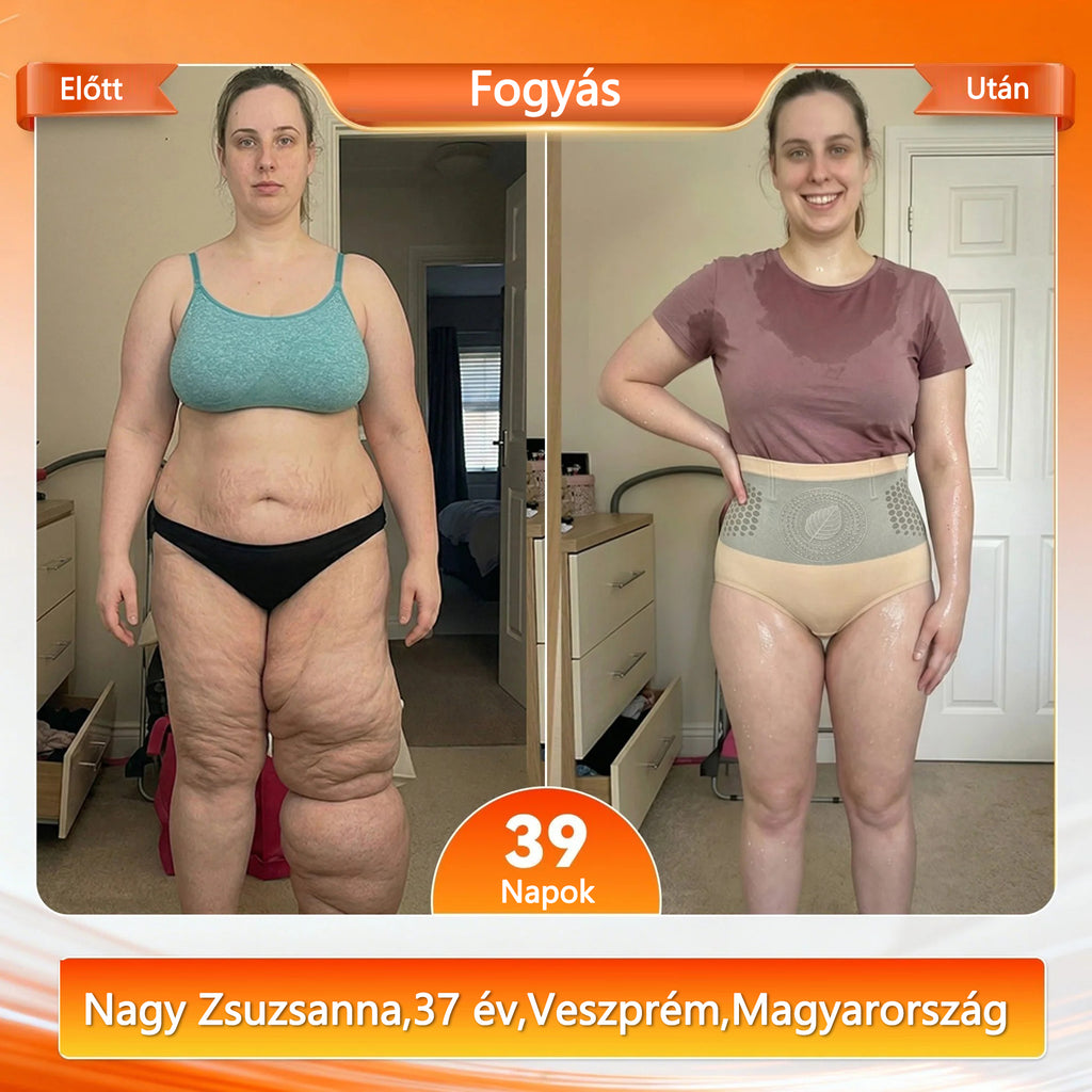 Hivatalos márkabolt |✅💫 COLTURE® 2026 Moringa & Berberine 4-in-1 mikrorészecskés alakformáló és zsírégető rövidnadrág