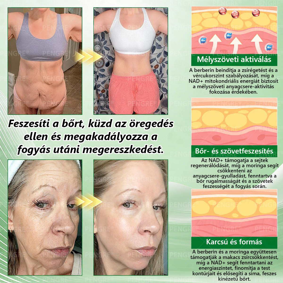 🌷𝐏𝐄𝐍𝑮𝑹𝐄® 𝗠𝗼𝗿𝗶𝗻𝗴𝗮 × 𝗕𝗲𝗿𝗯𝗲𝗿𝗶𝗻𝗲 × 𝗔𝗠𝗣𝗞 𝟭𝟬-𝗶𝗻-𝟭 𝗠𝗲𝘁𝗮𝗯𝗼𝗹𝗶𝗰 𝗦𝘂𝗽𝗽𝗼𝗿𝘁 𝗡𝗮𝗻𝗼 𝗠𝗶𝗰𝗿𝗼𝗻𝗲𝗲𝗱𝗹𝗲 𝗣𝗮𝘁𝗰𝗵 🇭🇺 (𝐍𝐚𝐩𝐨𝐧𝐭𝐚 𝐜𝐬𝐚𝐤 𝐞𝐠𝐲𝐬𝐳𝐞𝐫, 𝐥𝐚́𝐭𝐡𝐚𝐭𝐨́ 𝐯𝐚́𝐥𝐭𝐨𝐳𝐚́𝐬𝐨𝐤 𝐦𝐚́𝐫 𝟕 𝐧𝐚𝐩 𝐚𝐥𝐚𝐭𝐭) ✅ 𝐄𝐥𝐡𝐢́𝐳𝐚́𝐬𝐫𝐚, 𝐜𝐮𝐤𝐨𝐫𝐛𝐞𝐭𝐞𝐠𝐬𝐞́𝐠𝐫𝐞, 𝐚𝐥𝐯𝐚́𝐬𝐢 𝐚𝐩𝐧𝐨𝐞́𝐫𝐚, 𝐢́𝐳𝐮̈𝐥𝐞𝐭𝐢 𝐩𝐫𝐨𝐛𝐥𝐞́𝐦𝐚́𝐤𝐫𝐚 𝐞́𝐬 𝐦𝐞́𝐠 𝐬𝐨𝐤 𝐦𝐚́𝐬𝐫𝐚 🔥